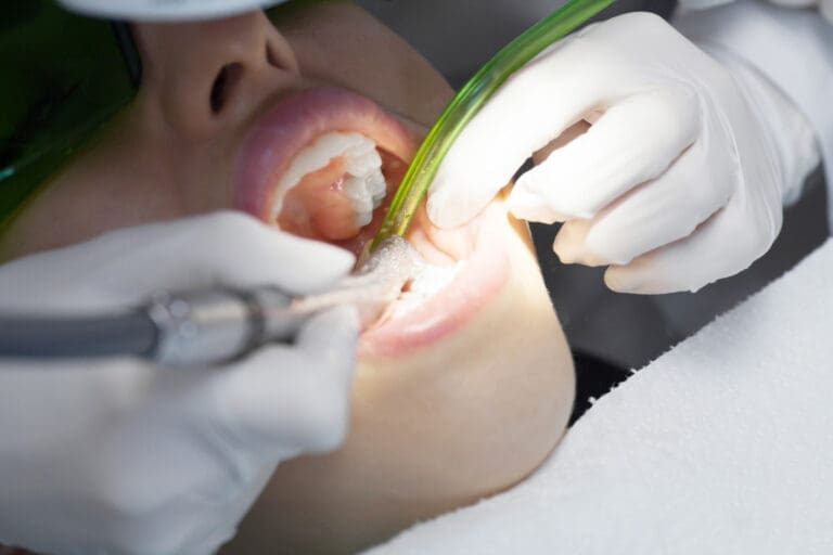 Okemos Dentist A close-up of a person receiving dental treatment at an Okemos dental clinic. A dentist wearing white gloves uses dental tools inside the patient’s open mouth, while the patient wears protective glasses.